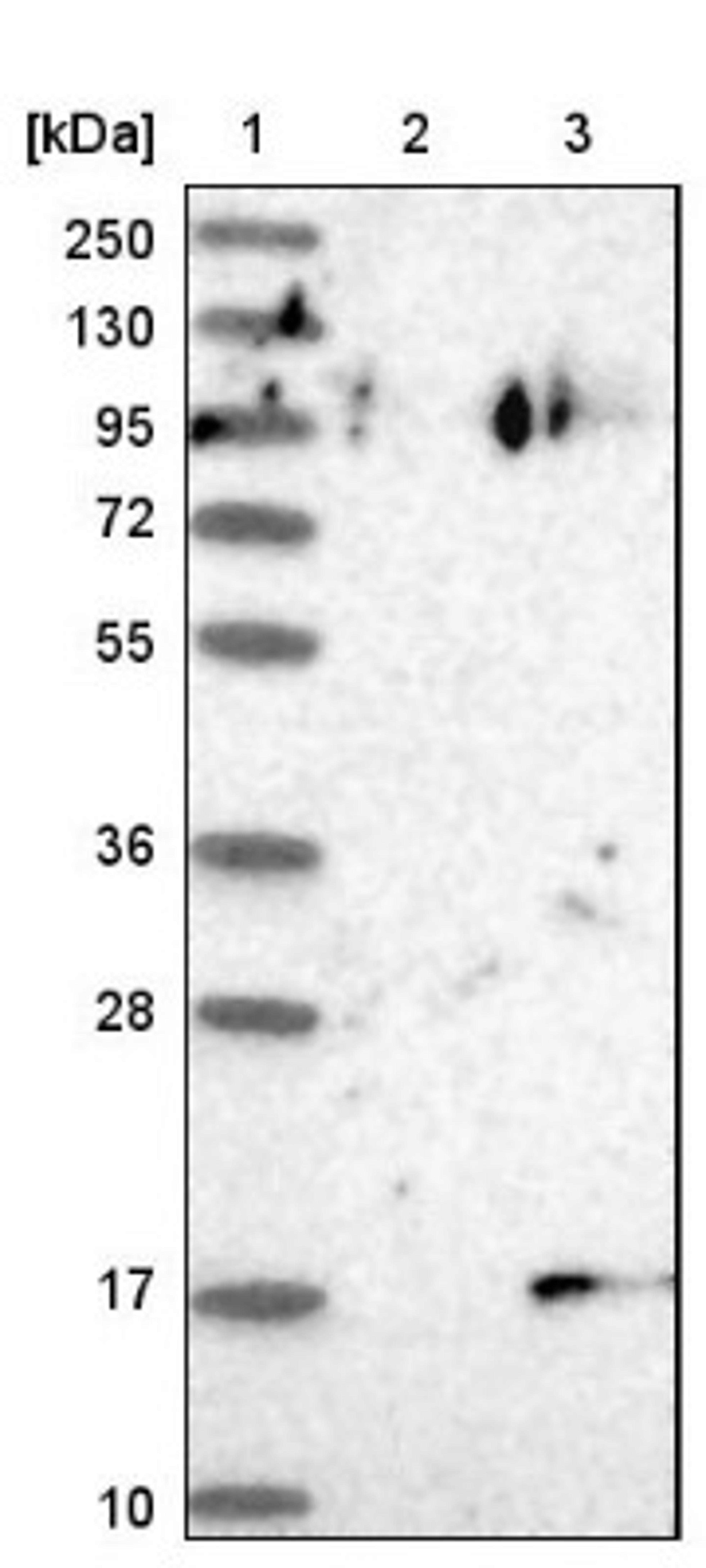 Western Blot: LIN52 Antibody [NBP1-88422] - Lane 1: Marker [kDa] 250, 130, 95, 72, 55, 36, 28, 17, 10<br/>Lane 2: Negative control (vector only transfected HEK293T lysate)<br/>Lane 3: Over-expression lysate (Co-expressed with a C-terminal myc-DDK tag (~3.1 kDa) in mammalian HEK293T cells, LY422531)