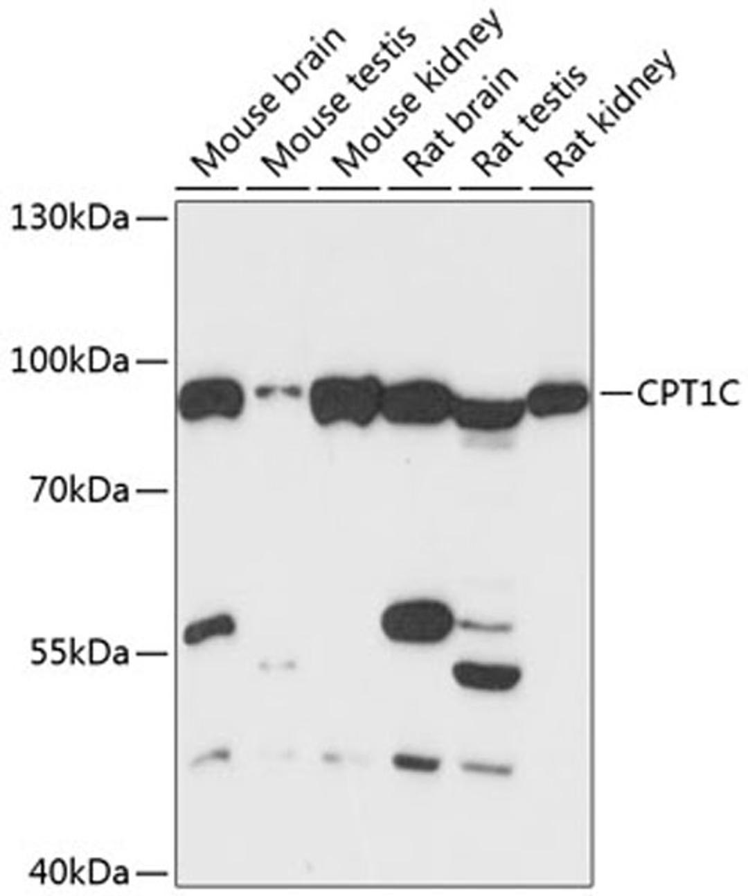 Western blot - CPT1C antibody (A13849)