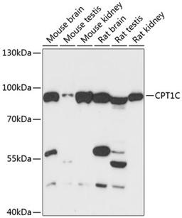 Western blot - CPT1C antibody (A13849)