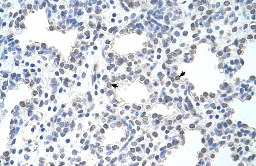 Antibody used in IHC on Human Intestine.