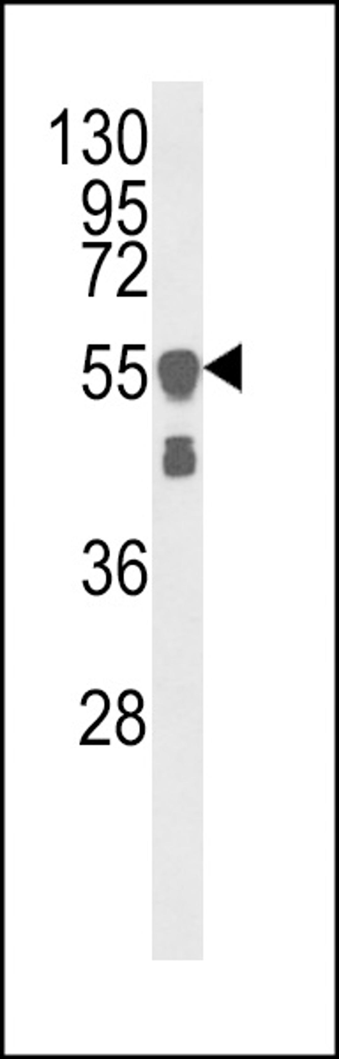 Western blot analysis of VIME Antibody in A375 cell line lysates (35ug/lane)