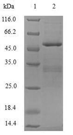 (Tris-Glycine gel) Discontinuous SDS-PAGE (reduced) with 5% enrichment gel and 15% separation gel.