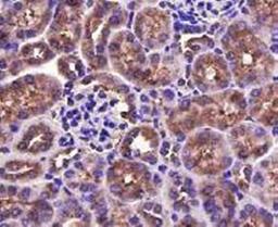 Immunohistochemical staining of mouse kidney tissue using TGF-Beta 1/2 antibody