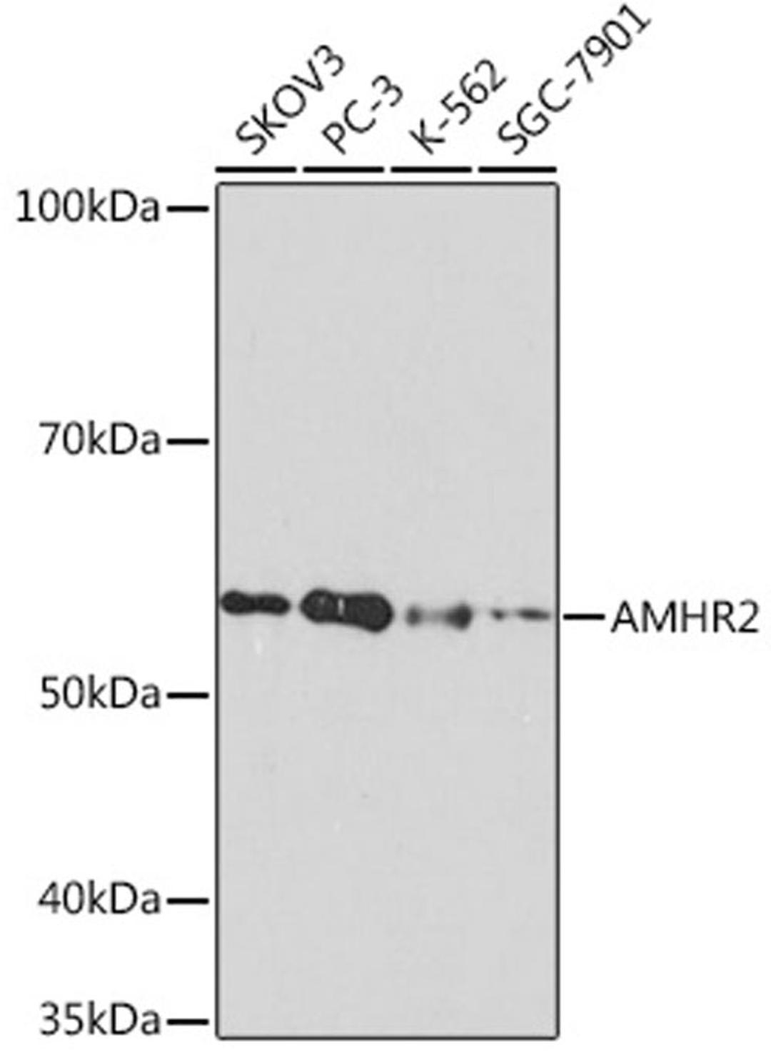 Western blot - AMHR2 Rabbit mAb (A8813)