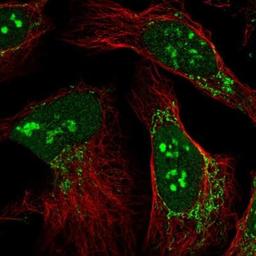 Immunocytochemistry/ Immunofluorescence: CXorf56 Antibody [NBP1-82098] - Staining of human cell line U-2 OS shows positivity in nucleus, nucleoli & mitochondria.