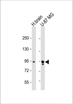 Western Blot at 1:1000 dilution Lane 1: human brain lysate Lane 2: U-87 MG whole cell lysate Lysates/proteins at 20 ug per lane.