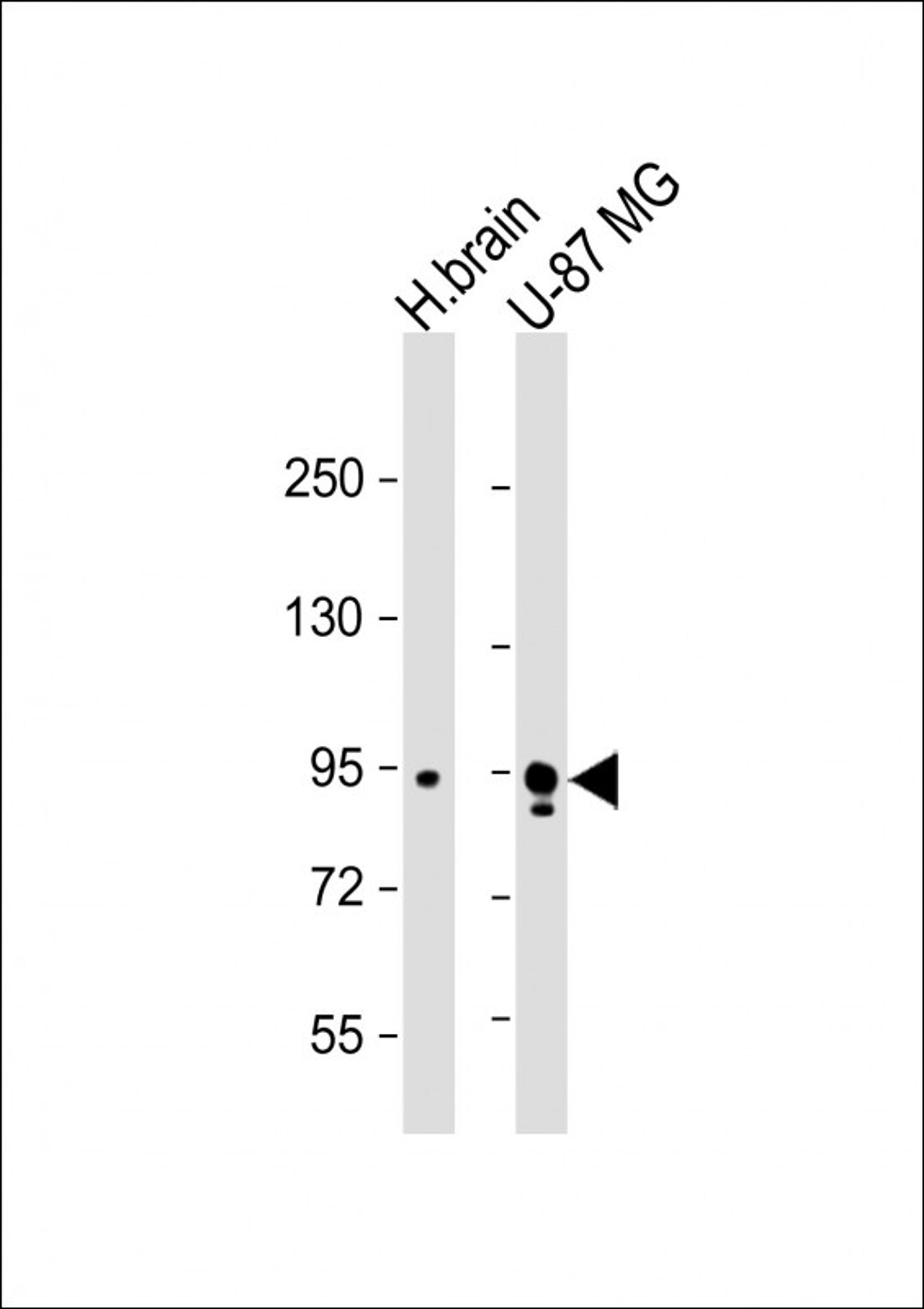 Western Blot at 1:1000 dilution Lane 1: human brain lysate Lane 2: U-87 MG whole cell lysate Lysates/proteins at 20 ug per lane.