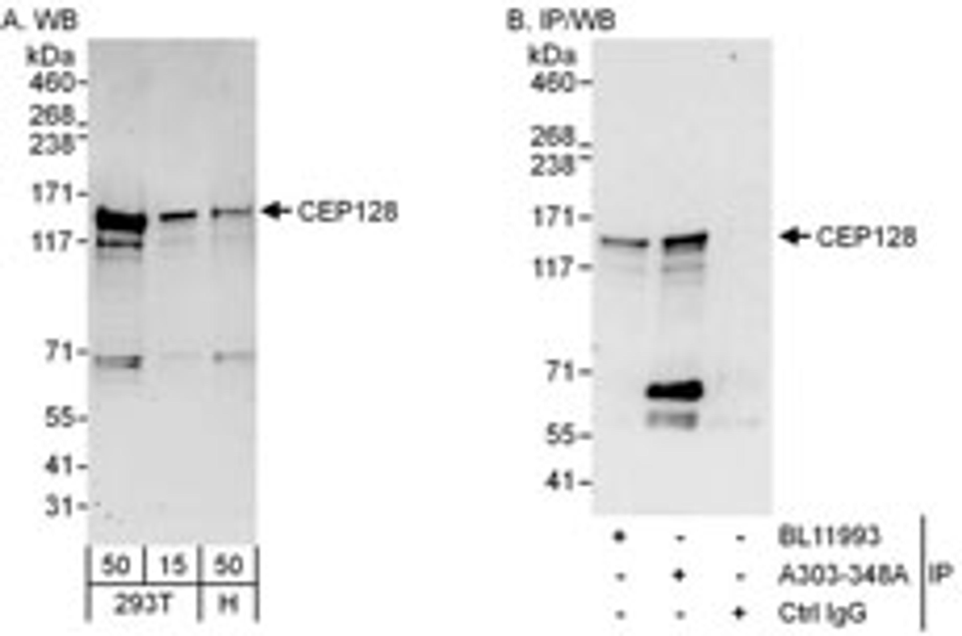 Detection of human CEP128 by western blot and immunoprecipitation.