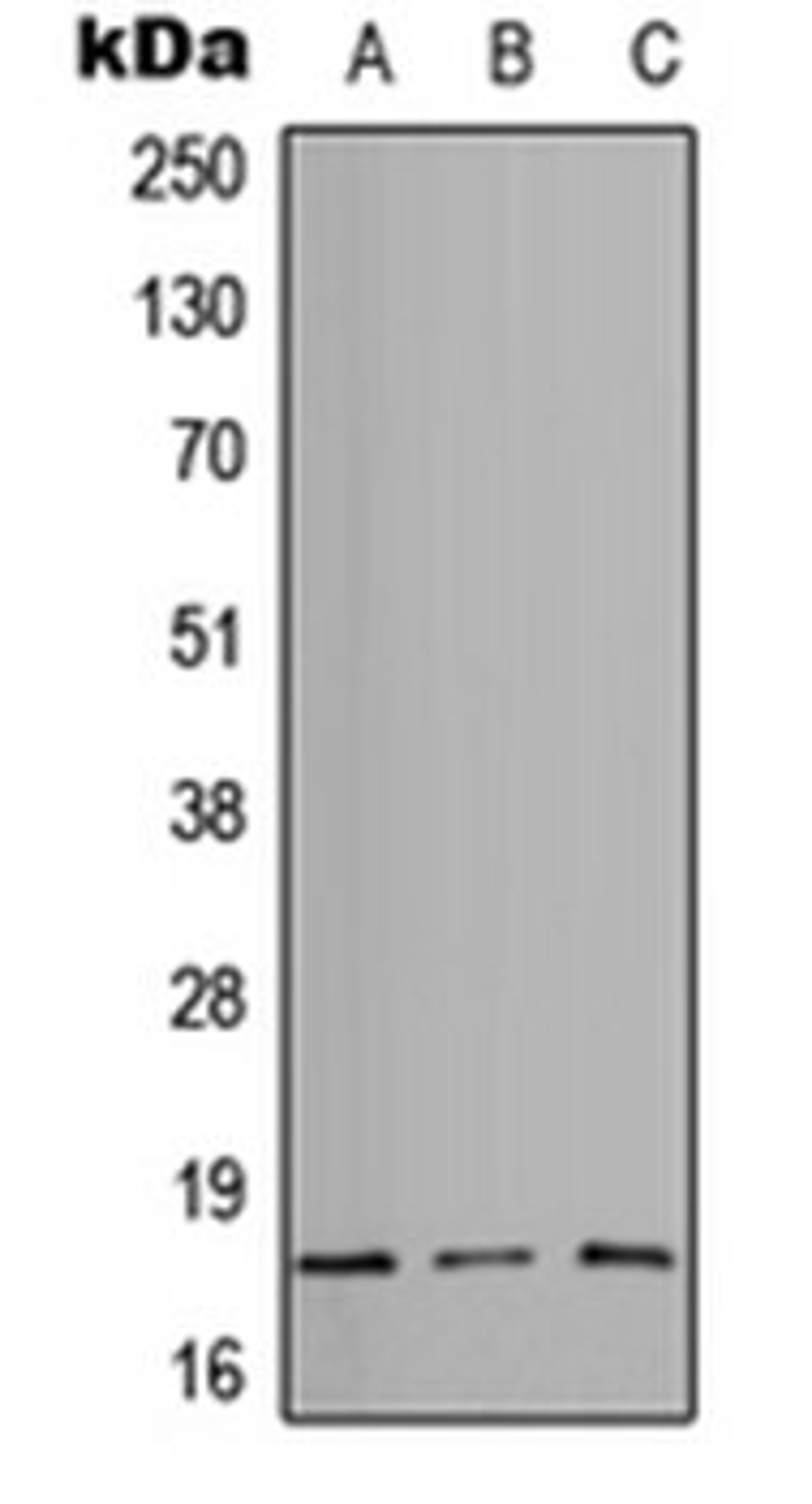 Western blot analysis of HEK293T (Lane 1), Raw264.7 (Lane 2), PC12 (Lane 3) whole cell lysates using CD49e HC antibody