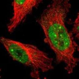 Immunocytochemistry/Immunofluorescence: Daxx Antibody [NBP1-85309] - Staining of human cell line U-251MG shows positivity in nucleus.