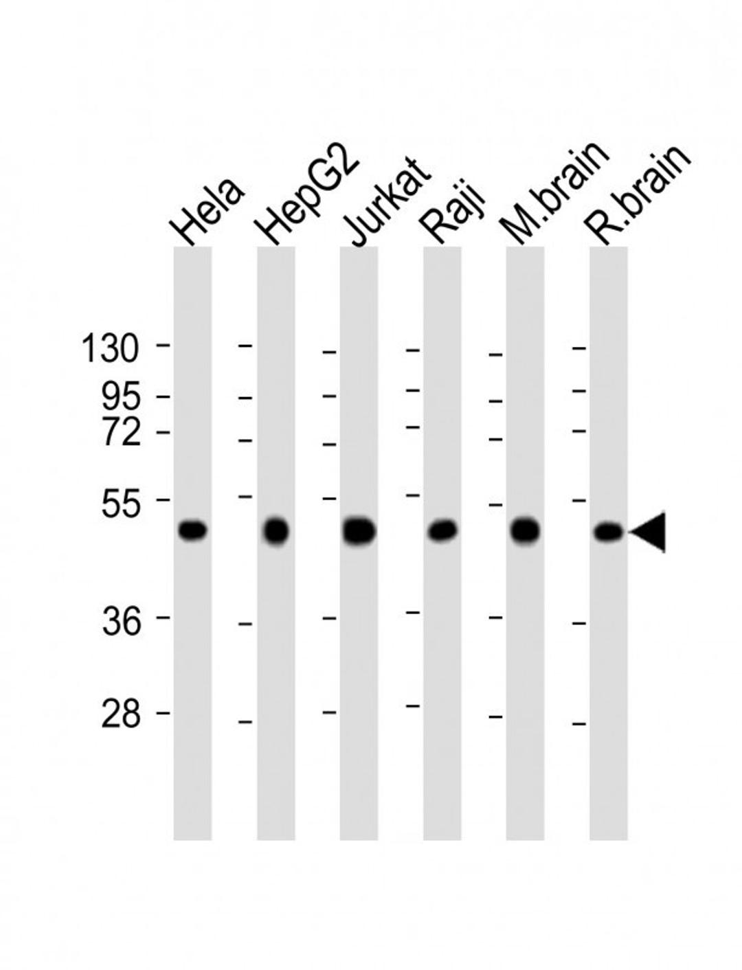 Western Blot at 1:2000 dilution Lane 1: Hela whole cell lysate Lane 2: HepG2 whole cell lysate Lane 3: Jurkat whole cell lysate Lane 4: Raji whole cell lysate Lane 5: mouse brain lysate Lane 6: rat brain lysate Lysates/proteins at 20 ug per lane.