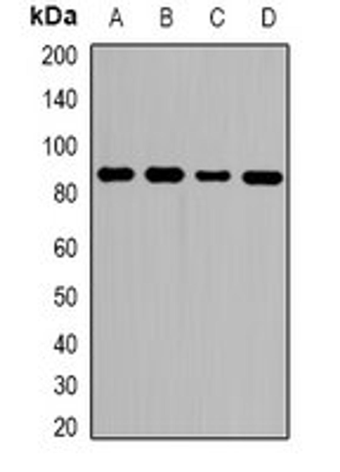 Western blot analysis of HeLa (Lane1), MCF7 (Lane2), RAW264.7 (Lane3), H9C2 (Lane4) whole cell lysates using ZNF839 antibody