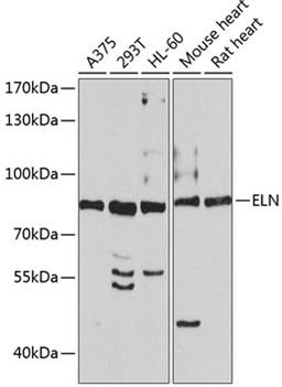 Western blot - ELN antibody (A2723)