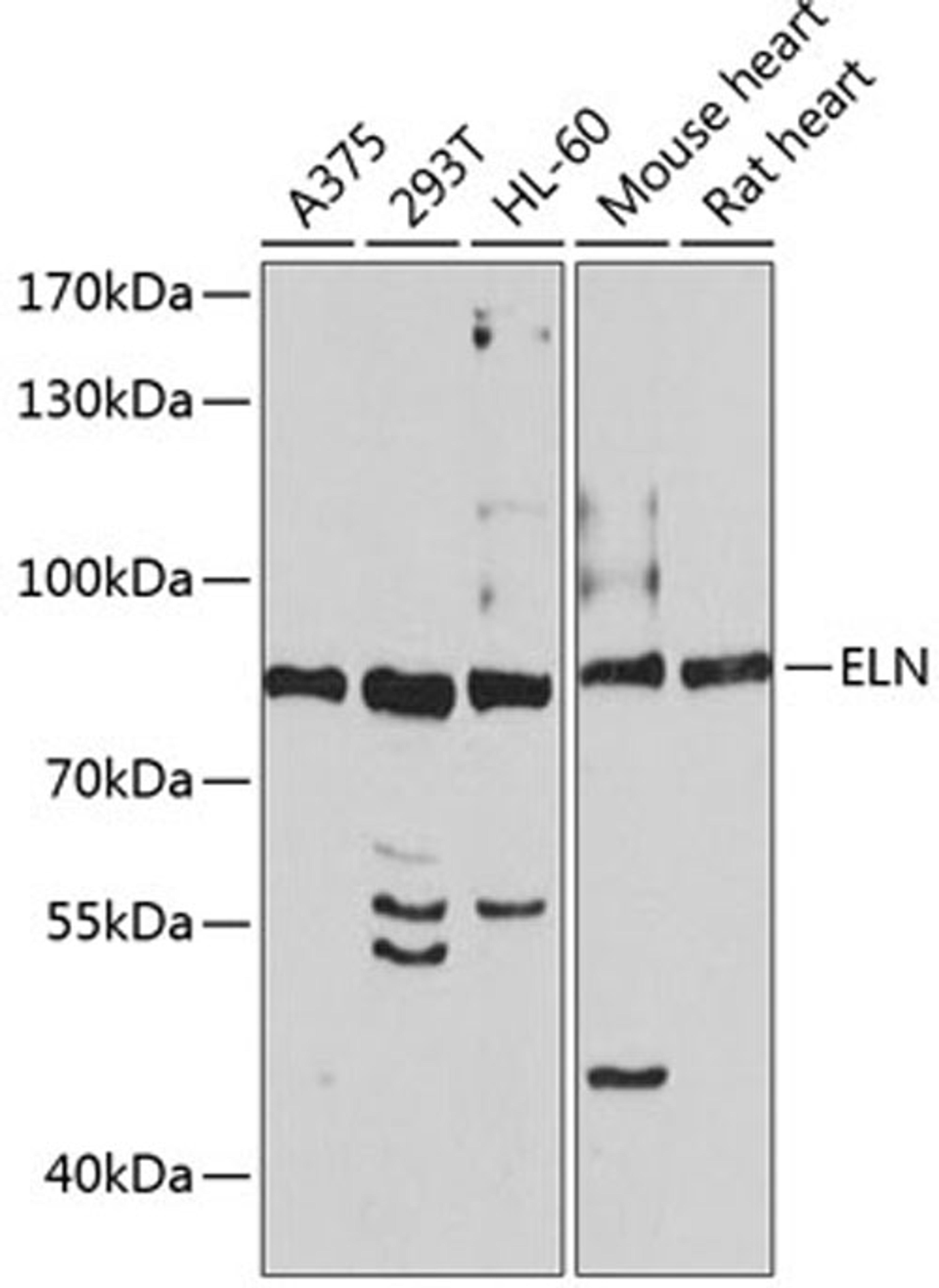 Western blot - ELN antibody (A2723)