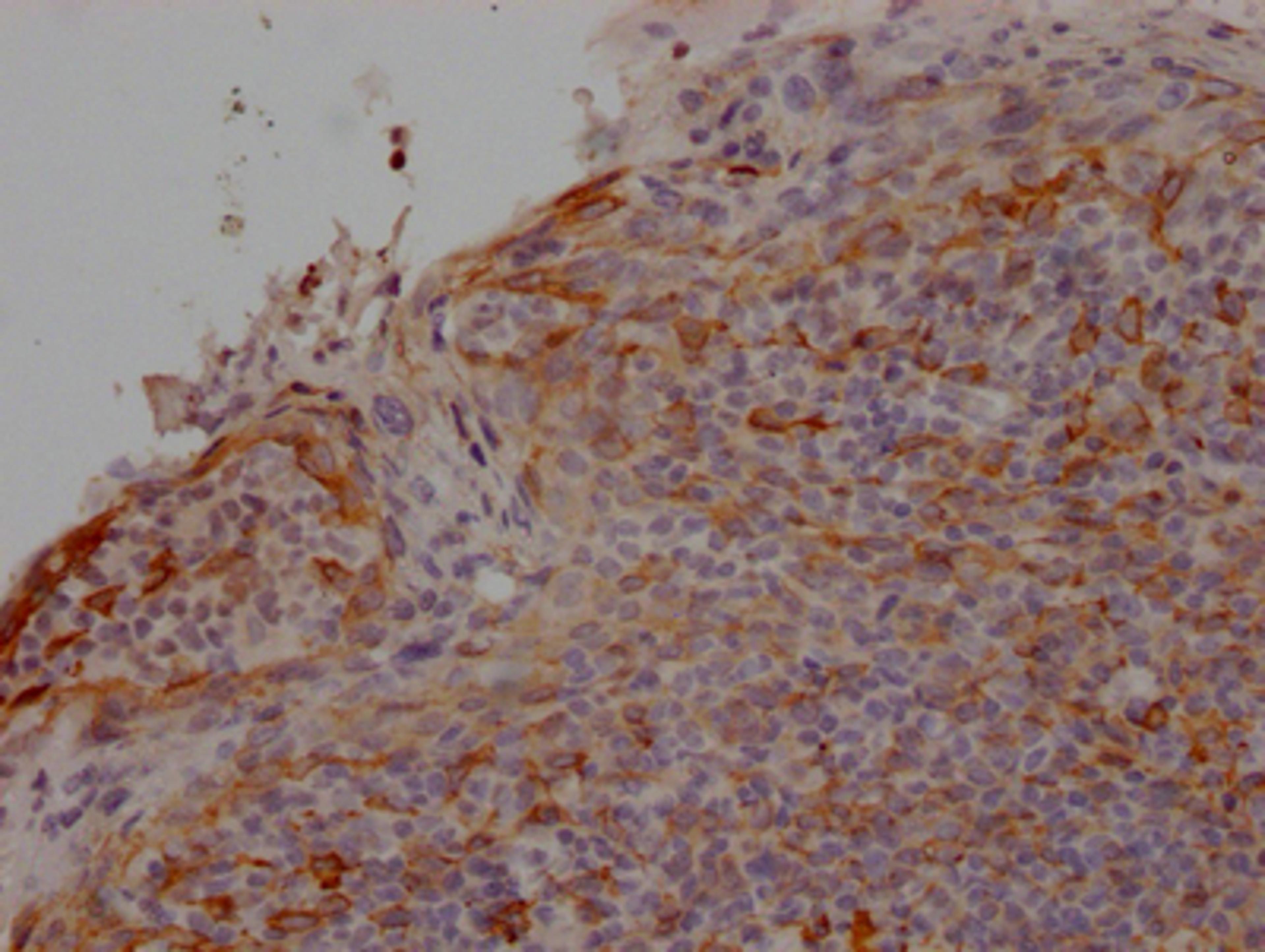 IHC image of CSB-RA297464A0HU diluted at 1:100 and staining in paraffin-embedded human tonsil tissue performed on a Leica BondTM system. After dewaxing and hydration, antigen retrieval was mediated by high pressure in a citrate buffer (pH 6.0). Section was blocked with 10% normal goat serum 30min at RT. Then primary antibody (1% BSA) was incubated at 4℃ overnight. The primary is detected by a Goat anti-rabbit IgG polymer labeled by HRP and visualized using 0.05% DAB.