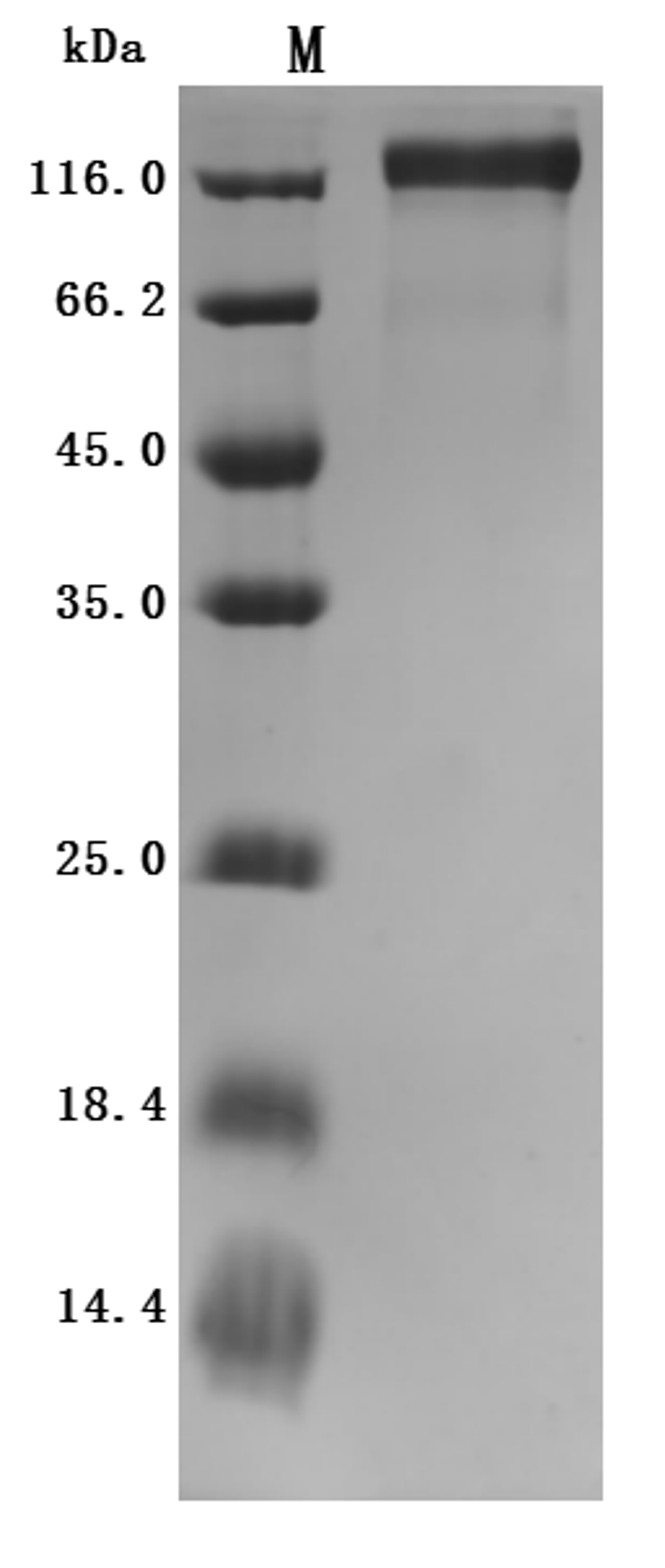 (Tris-Glycine gel) Discontinuous SDS-PAGE (reduced) with 5% enrichment gel and 15% separation gel.