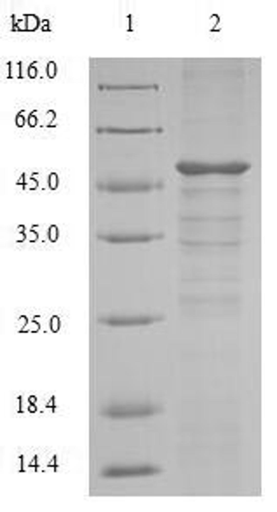 (Tris-Glycine gel) Discontinuous SDS-PAGE (reduced) with 5% enrichment gel and 15% separation gel.