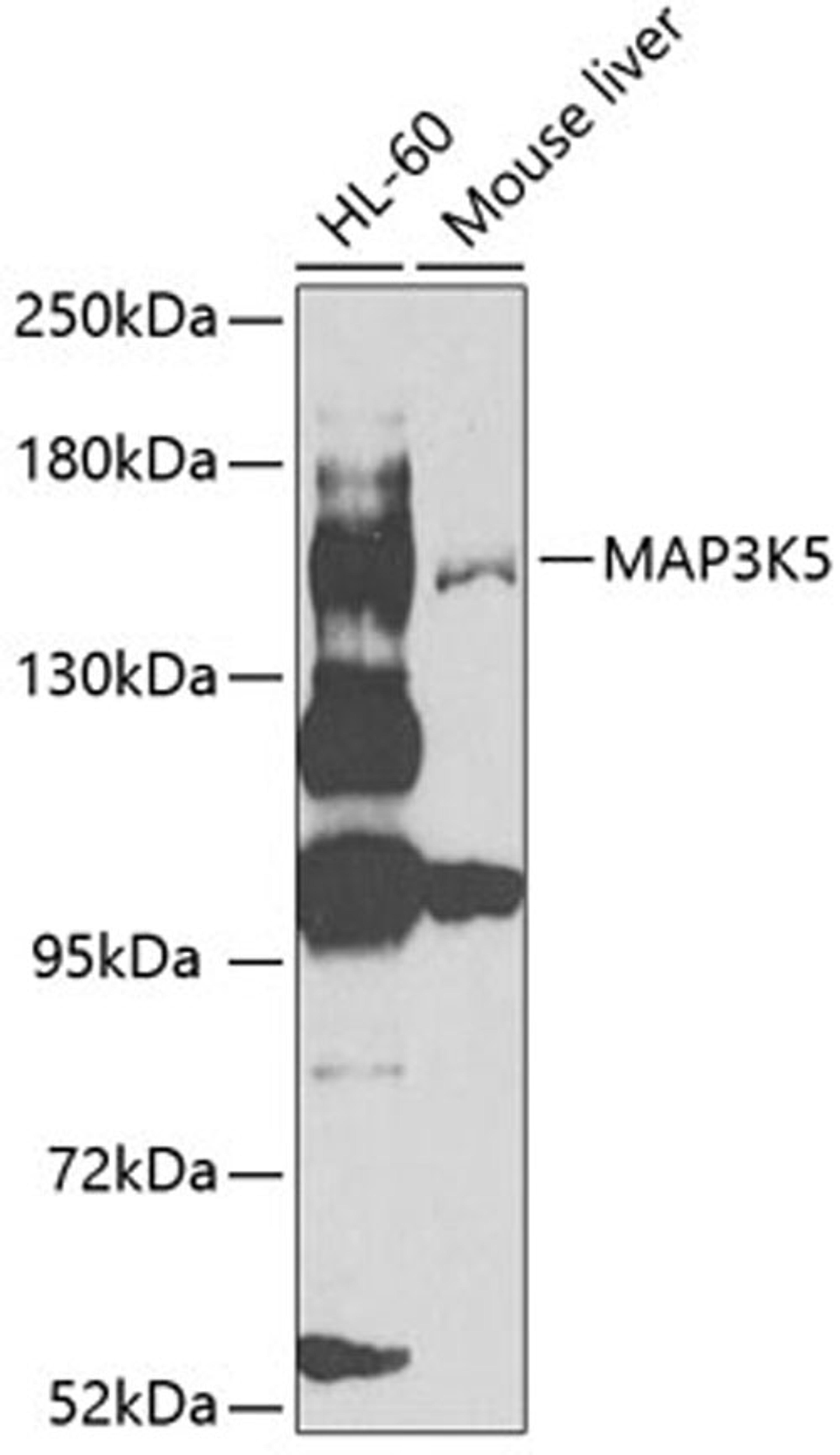 Western blot - MAP3K5 antibody (A0283)