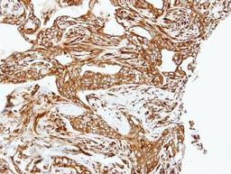 Immunohistochemistry-Paraffin: Lysyl Oxidase Homolog 2/LOXL2 Antibody [NBP1-32954] - Paraffin-embedded H661 xenograft, using antibody at 1:500 dilution.