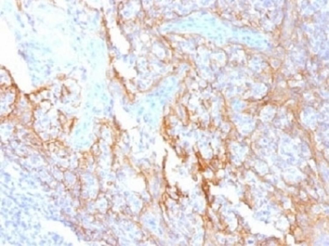 IHC testing of FFPE human tonsil tissue with Beta Catenin antibody (clone 15B8). Required HIER: boil tissue sections in 10mM Tris with 1mM EDTA, pH 9.0, for 10-20 min.