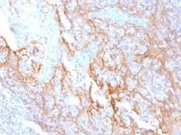 IHC testing of FFPE human tonsil tissue with Beta Catenin antibody (clone 15B8). Required HIER: boil tissue sections in 10mM Tris with 1mM EDTA, pH 9.0, for 10-20 min.