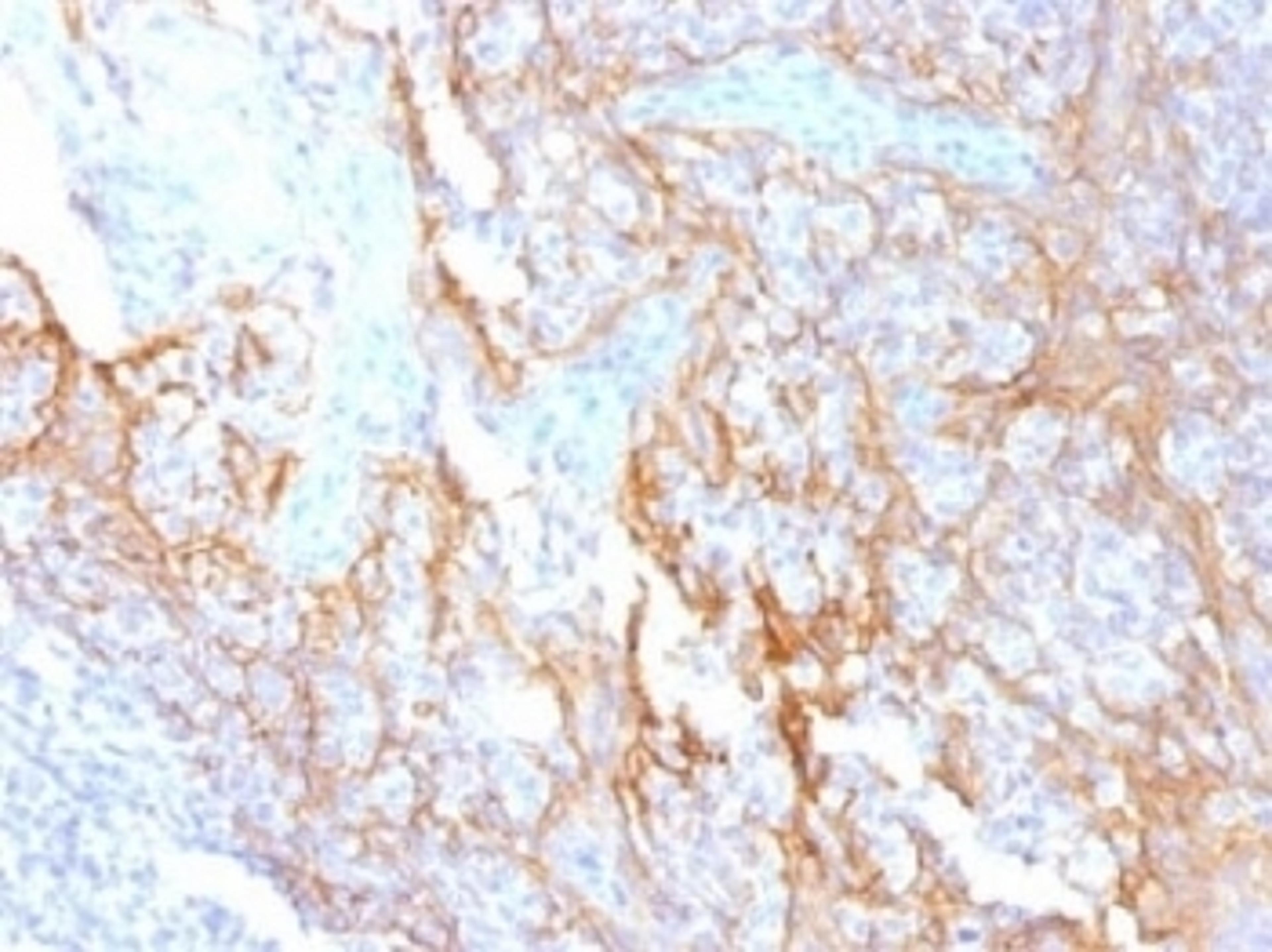 IHC testing of FFPE human tonsil tissue with Beta Catenin antibody (clone 15B8). Required HIER: boil tissue sections in 10mM Tris with 1mM EDTA, pH 9.0, for 10-20 min.