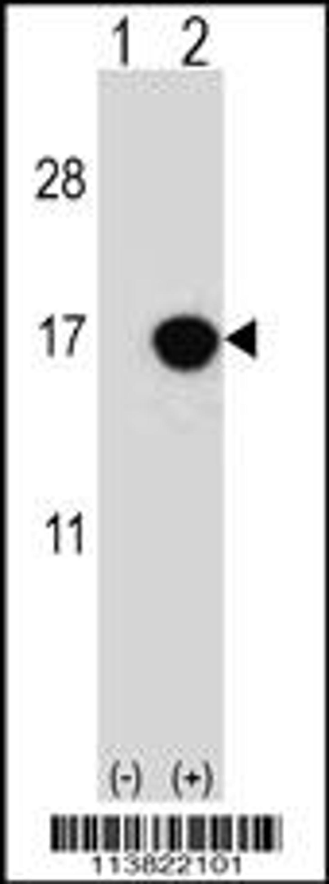 Western blot analysis of CDKN2B using rabbit polyclonal CDKN2B Antibody using 293 cell lysates (2 ug/lane) either nontransfected (Lane 1) or transiently transfected (Lane 2) with the CDKN2B gene.