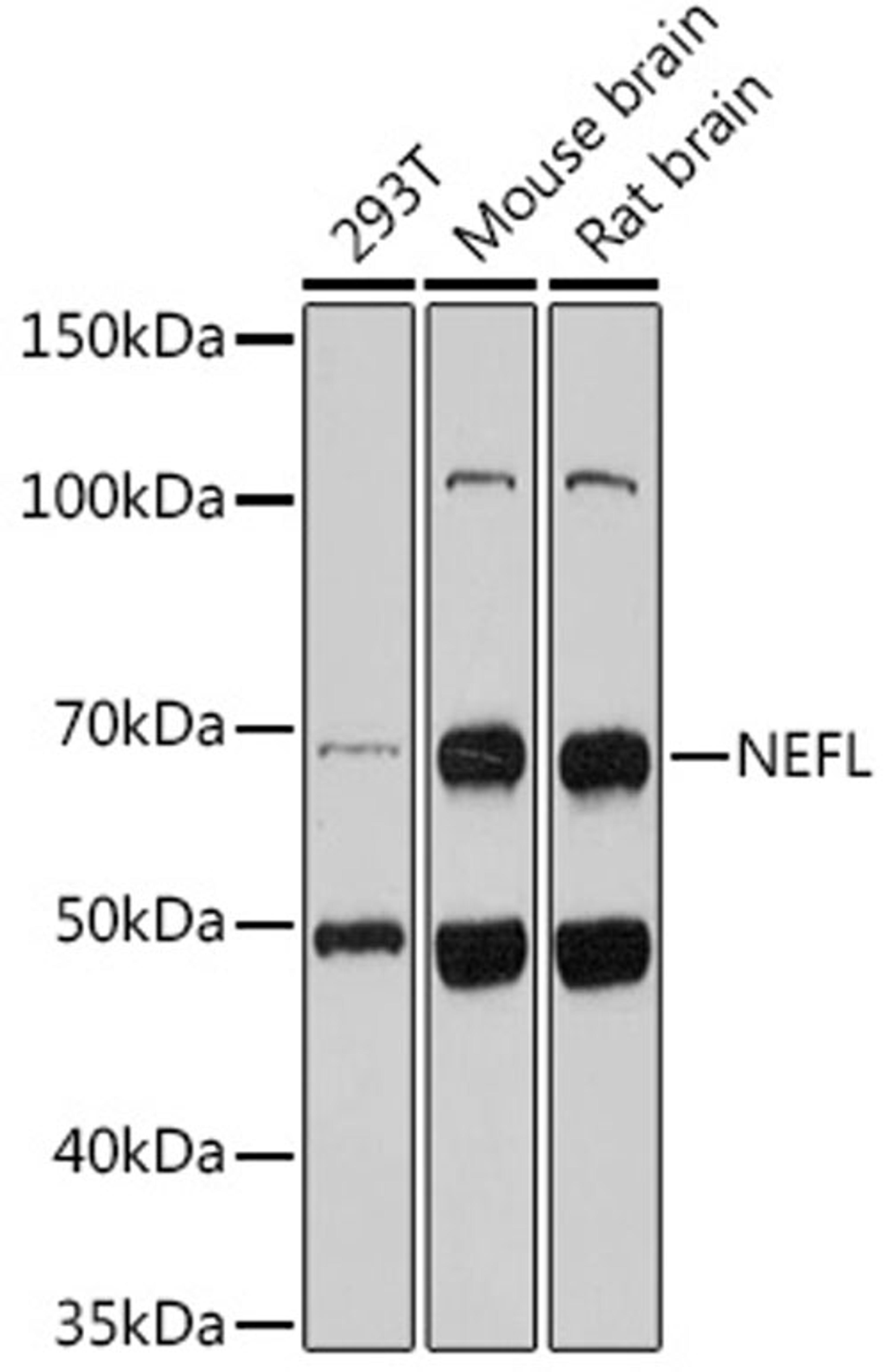 Western blot - NEFL antibody (A0257)