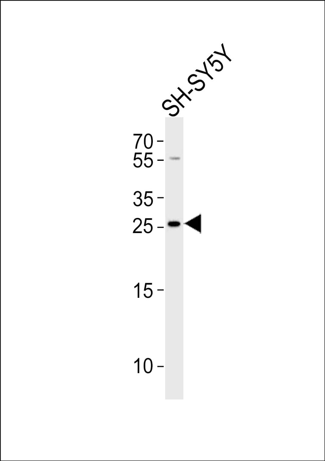 Western blot analysis of lysate from SH-SY5Y cell line, using ZDHHC21 Antibody at 1:1000.