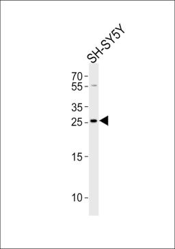 Western blot analysis of lysate from SH-SY5Y cell line, using ZDHHC21 Antibody at 1:1000.