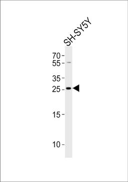 Western blot analysis of lysate from SH-SY5Y cell line, using ZDHHC21 Antibody at 1:1000.