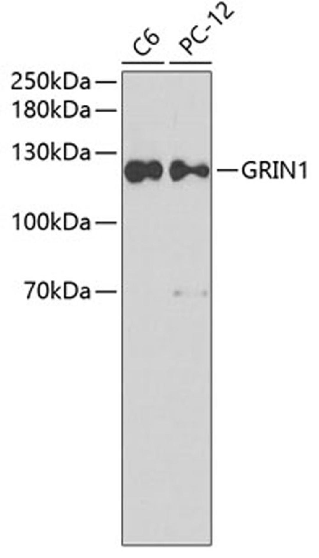 Western blot - GRIN1 antibody (A7167)