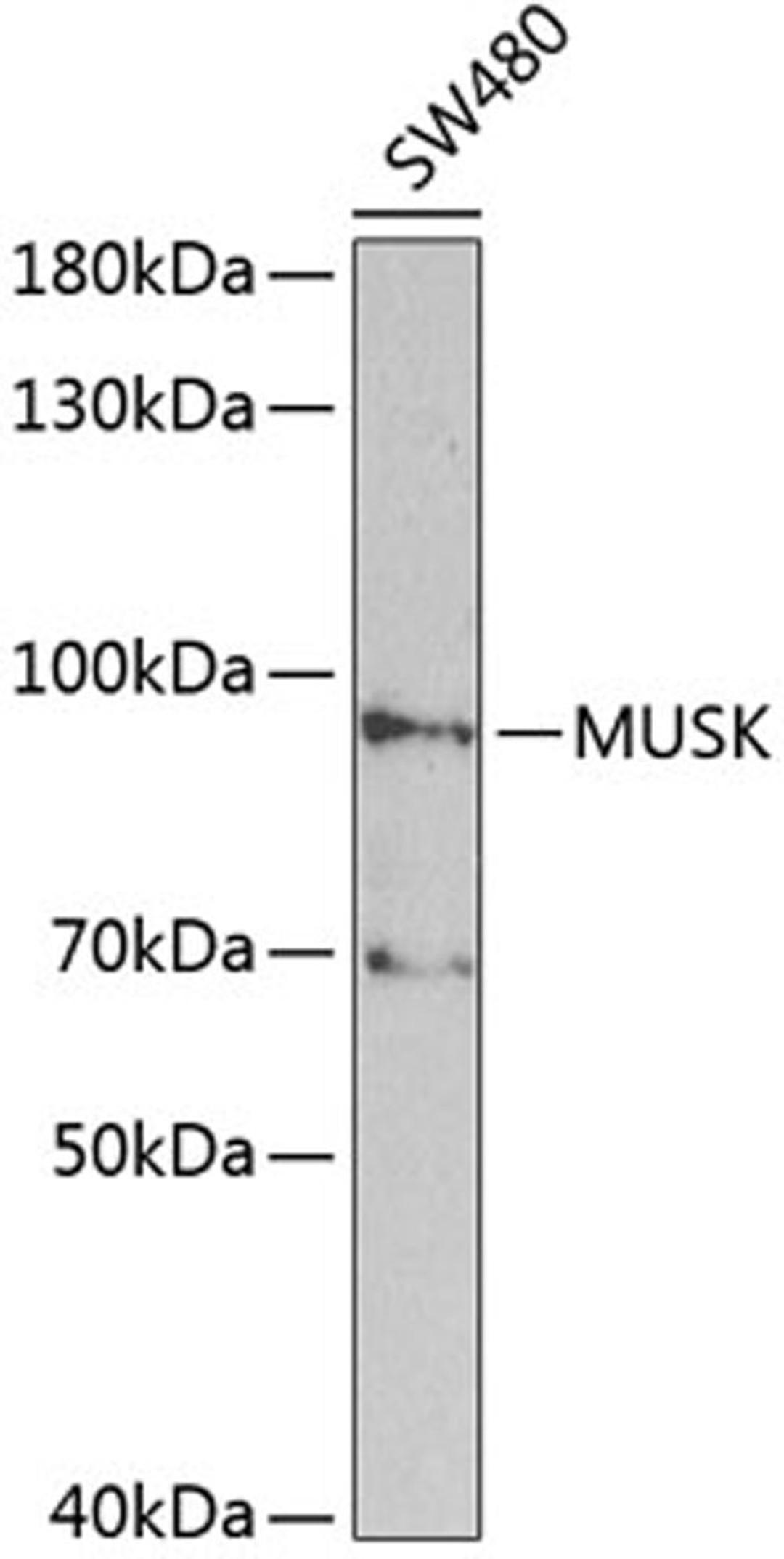 Western blot - MUSK antibody (A2591)