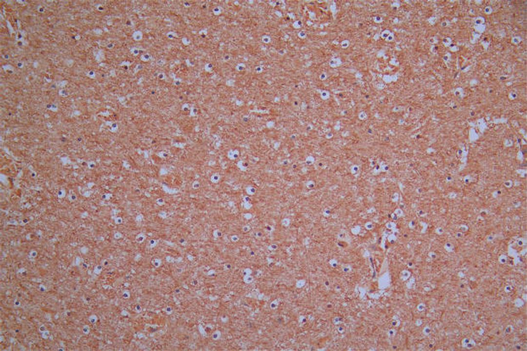 IHC image of CSB-RA896760MA1HU diluted at 1:30 and staining in paraffin-embedded human brain tissue performed on a Leica BondTM system. After dewaxing and hydration,  antigen retrieval was mediated by high pressure in a citrate buffer (pH 6.0). Section was blocked with 10% normal goat serum 30min at RT. Then primary antibody (1% BSA) was incubated at 4°C overnight. The primary is detected by a Goat anti-Mouse IgG labeled by HRP and visualized using 0.05% DAB.