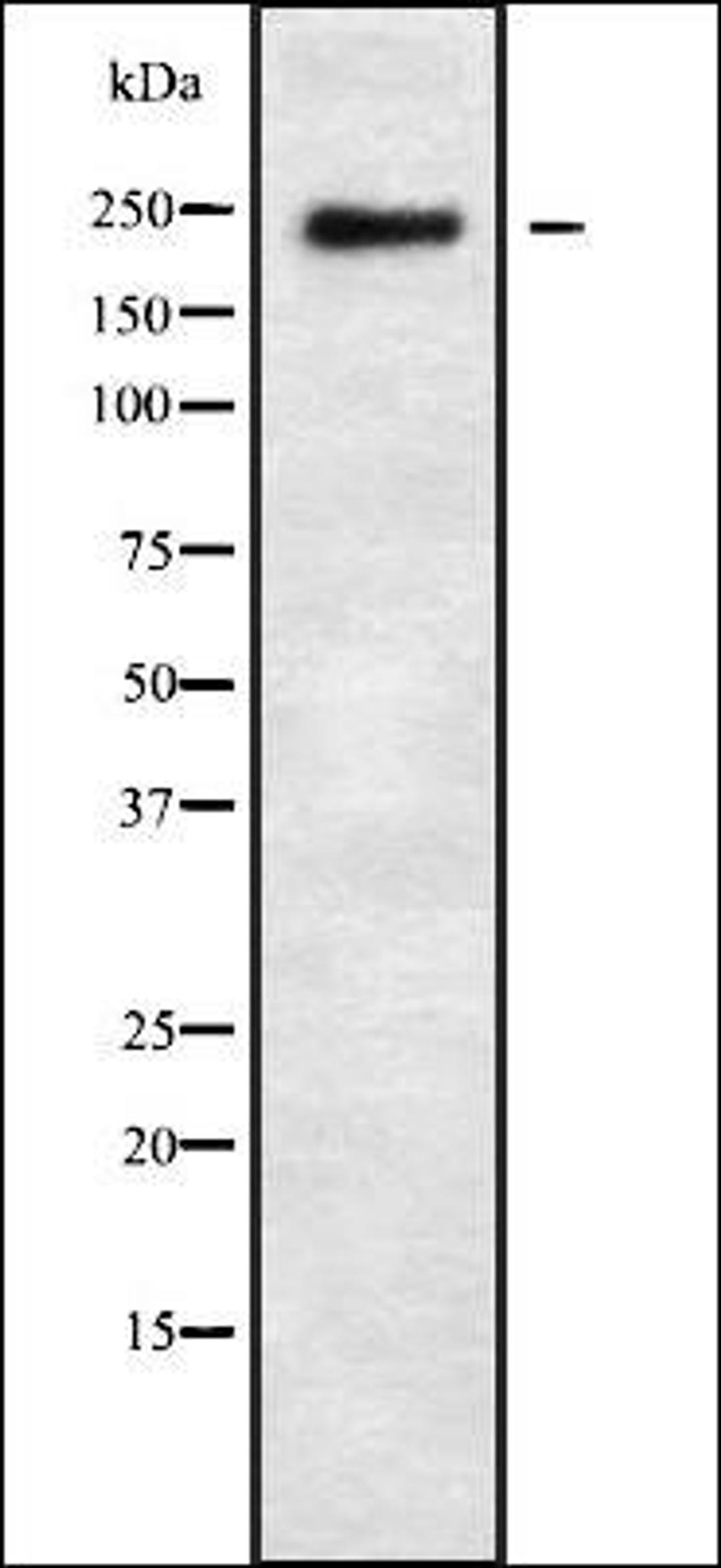 Western blot analysis of 293 whole cell lysates using FANCM antibody