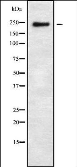 Western blot analysis of 293 whole cell lysates using FANCM antibody