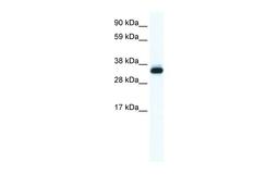 Antibody used in WB on Human Placenta at 0.625 ug/ml.