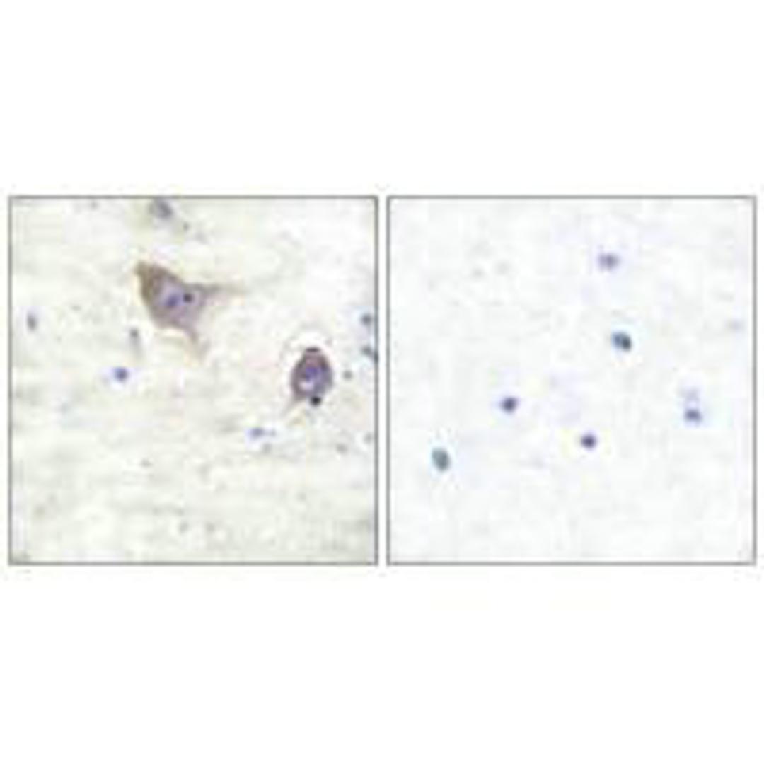 Immunohistochemical analysis of paraffin-embedded human brain tissue using Synuclein β antibody.