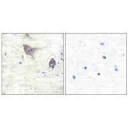 Immunohistochemical analysis of paraffin-embedded human brain tissue using Synuclein β antibody.