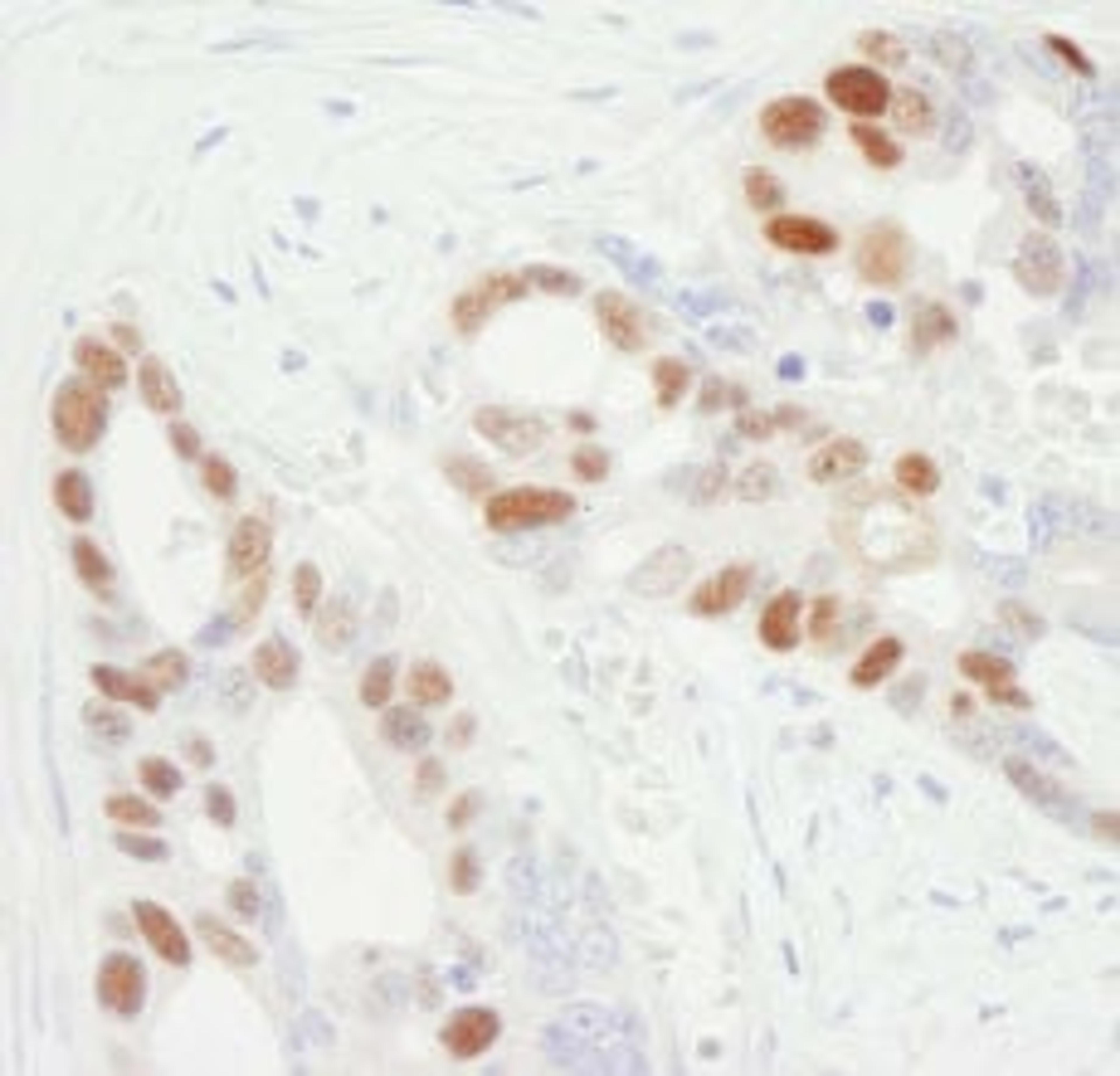 Detection of human MCM6 by immunohistochemistry.