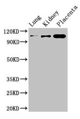 Western Blot. Positive WB detected in: Mouse lung tissue, Mouse kidney tissue, Human placenta tissue. All lanes: MSH4 antibody at 3µg/ml. Secondary. Goat polyclonal to rabbit IgG at 1/50000 dilution. Predicted band size: 105 kDa. Observed band size: 105 kDa