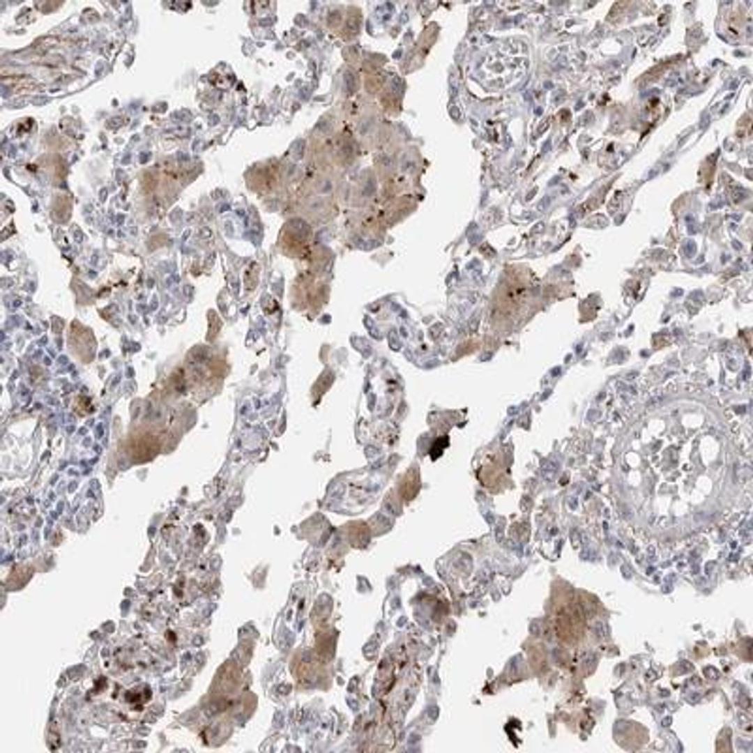 Immunohistochemistry: EYS/RP25 Antibody [NBP1-90038] - Staining of human lung shows moderate cytoplasmic positivity in lung macrophages.