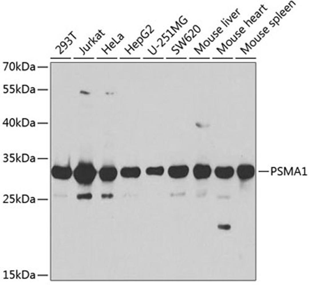 Western blot - PSMA1 antibody (A2523)