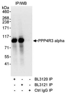 Detection of human PPP4R3 Alpha by western blot of immunoprecipitates.