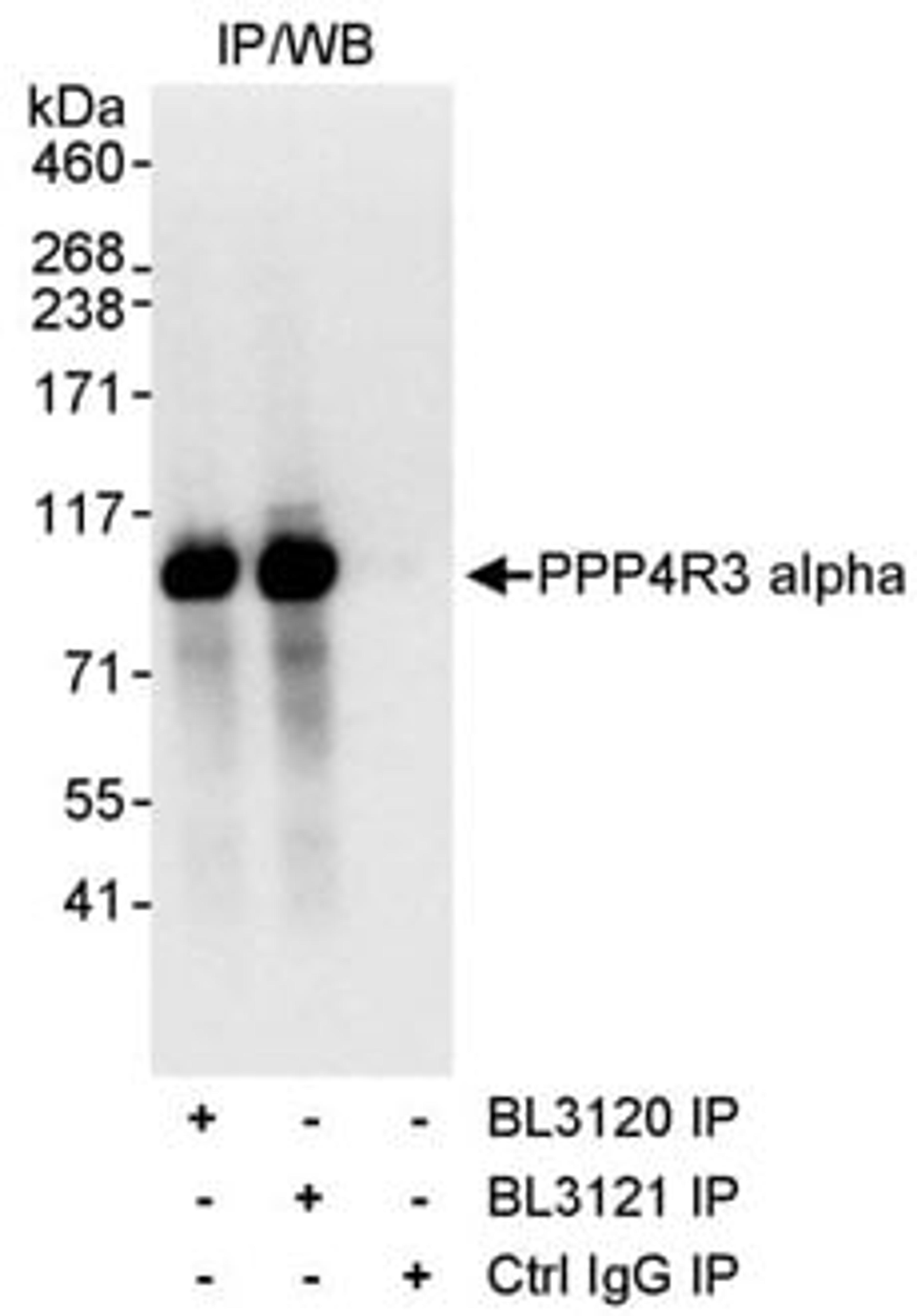 Detection of human PPP4R3 Alpha by western blot of immunoprecipitates.