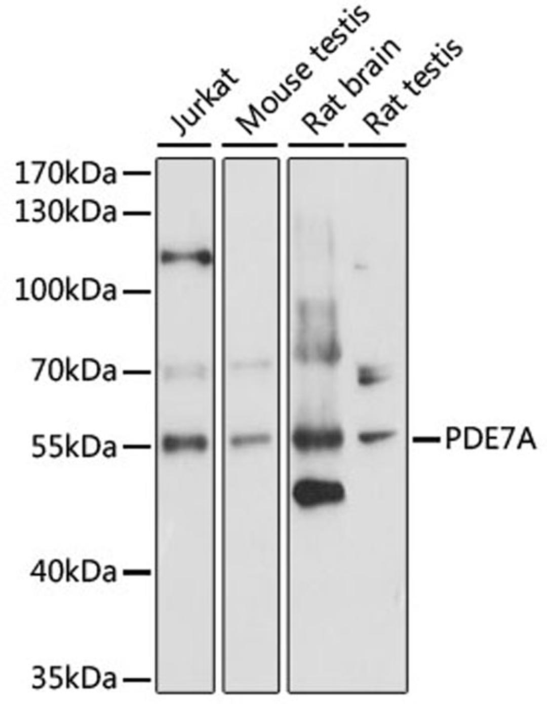 Western blot - PDE7A antibody (A15079)