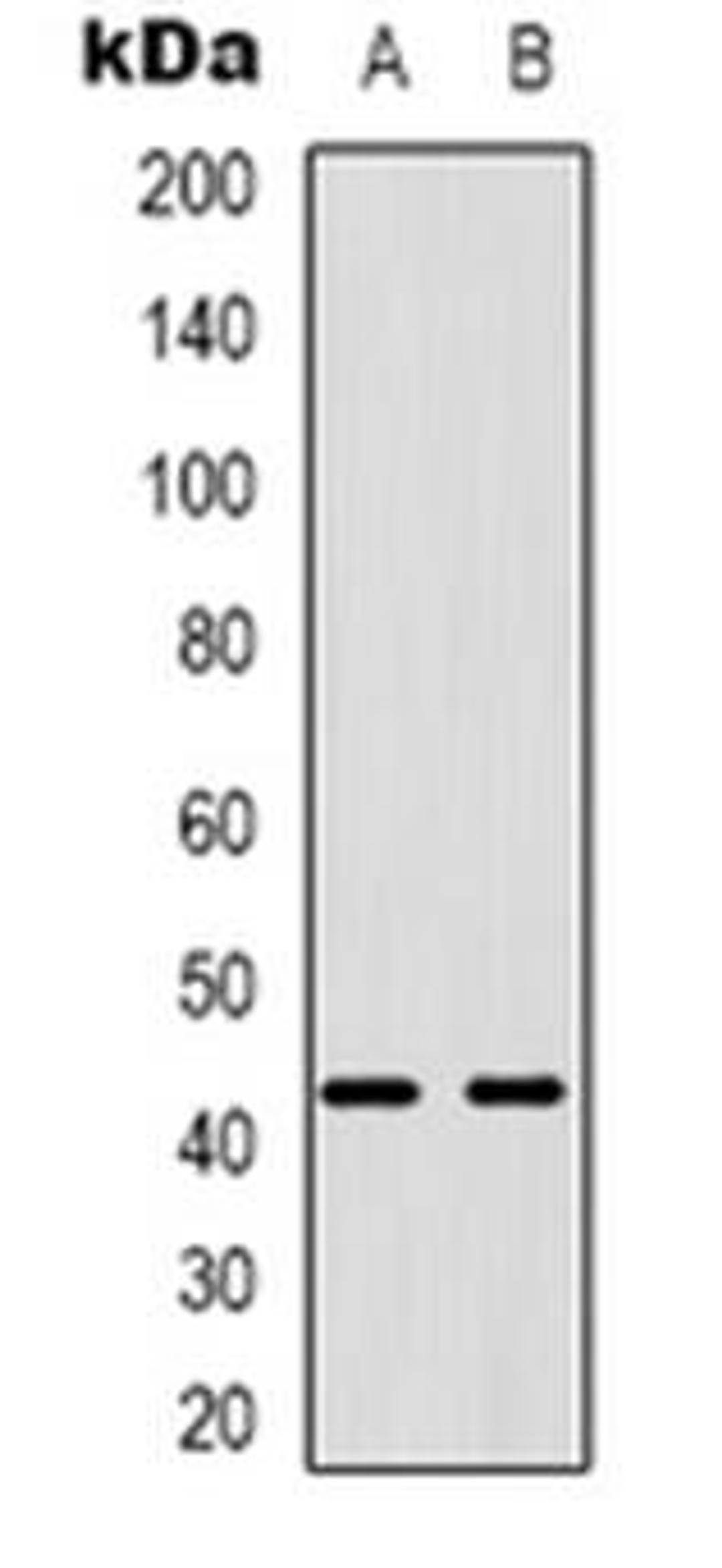 Western blot analysis of PABPC5 expression in U87MG (Lane 1), K562 (Lane 2) whole cell lysates using PABPC5 antibody