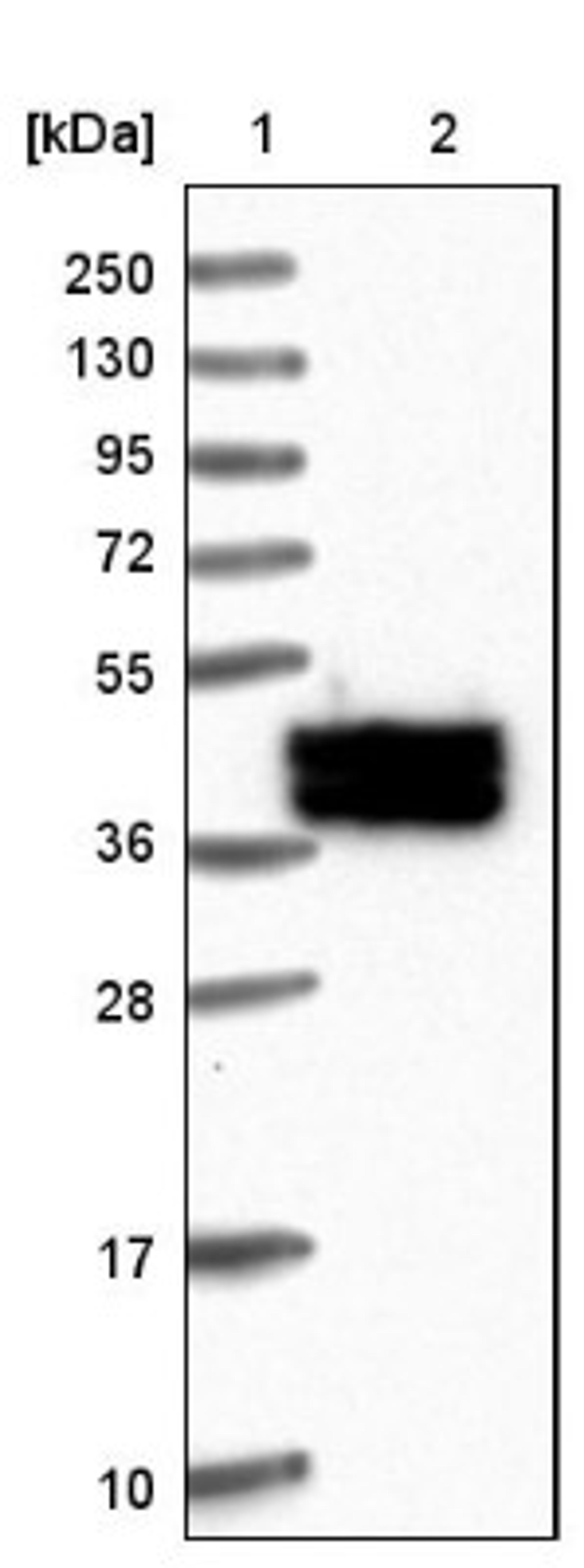 Western Blot: SESN3 Antibody [NBP1-82717] - Lane 1: Marker [kDa] 250, 130, 95, 72, 55, 36, 28, 17, 10<br/>Lane 2: Human cell line RT-4