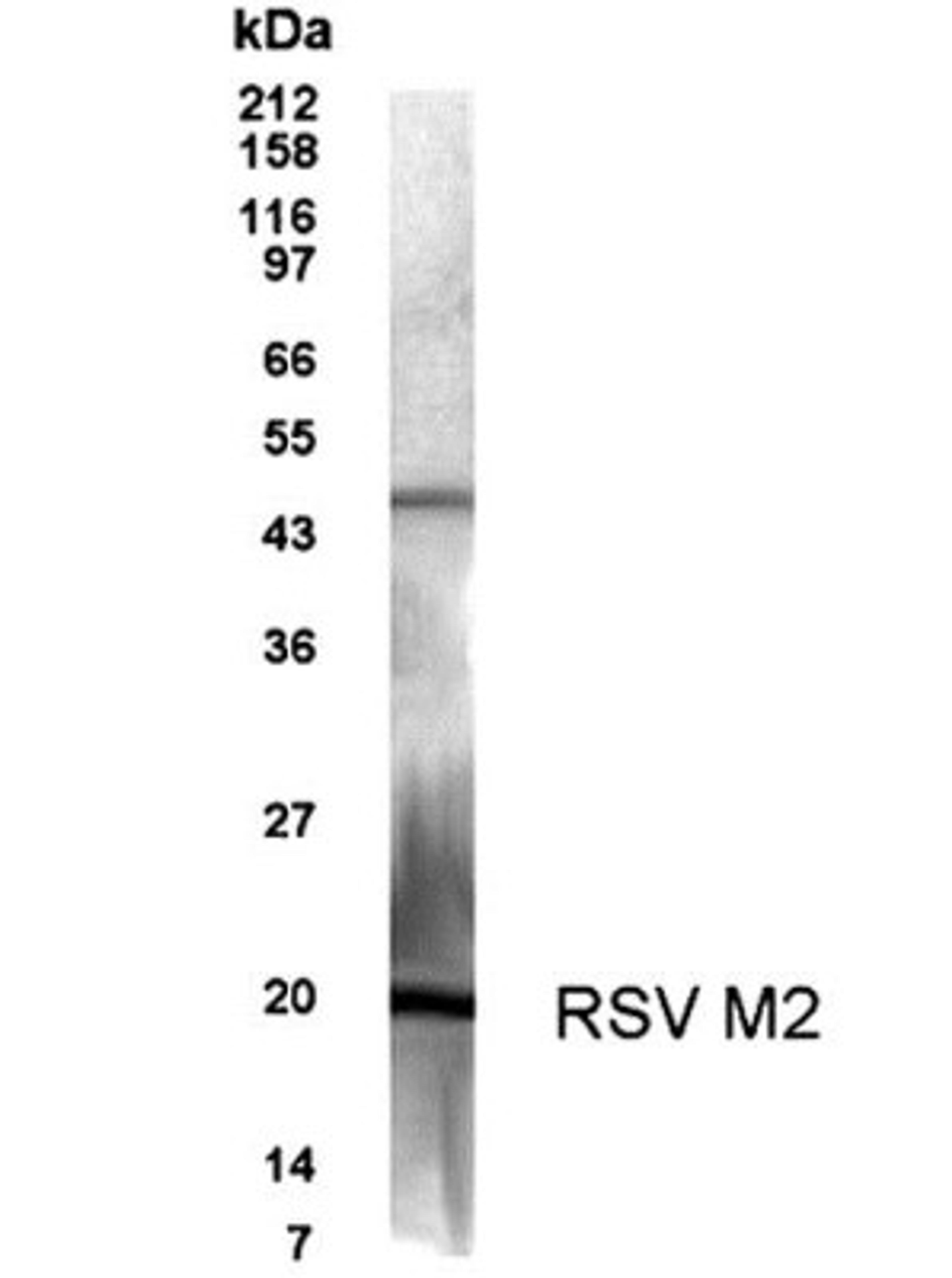 Western Blot: Respiratory Syncytial Virus M2 protein Antibody [NB100-93589] - Detection of Respiratory Syncytial Virus M2 (RSV M2) protein in infected Hep-2 cell lysate with this antibody at a dilution of 1: 500