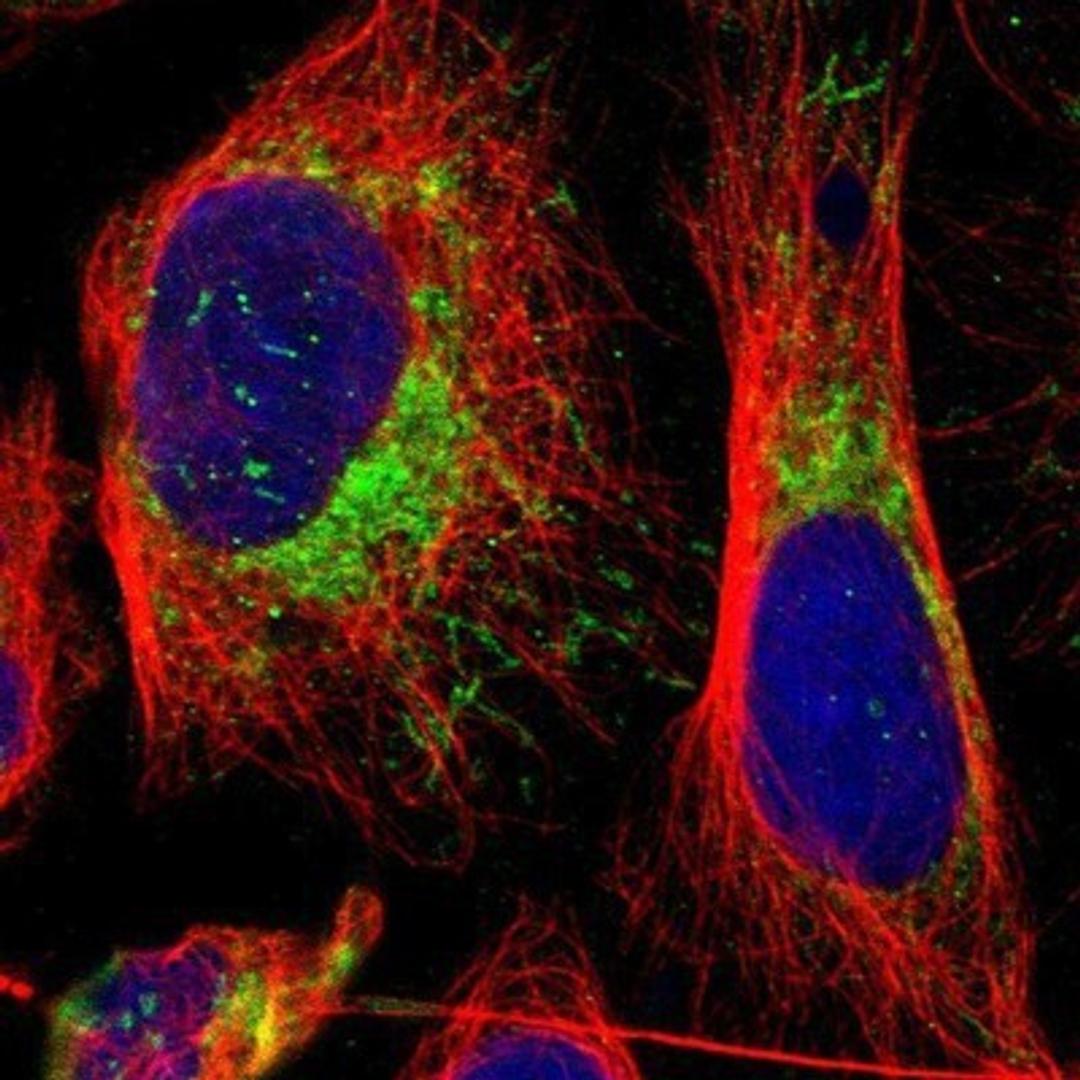 Immunocytochemistry/Immunofluorescence: MRPL45 Antibody [NBP1-82763] - Staining of human cell line U-2 OS shows positivity in mitochondria.